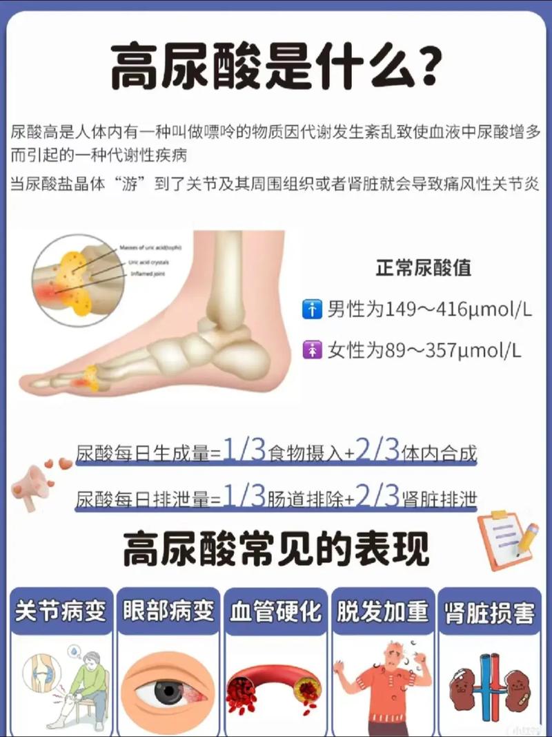 什么是尿酸血症-尿酸血症是怎么回事