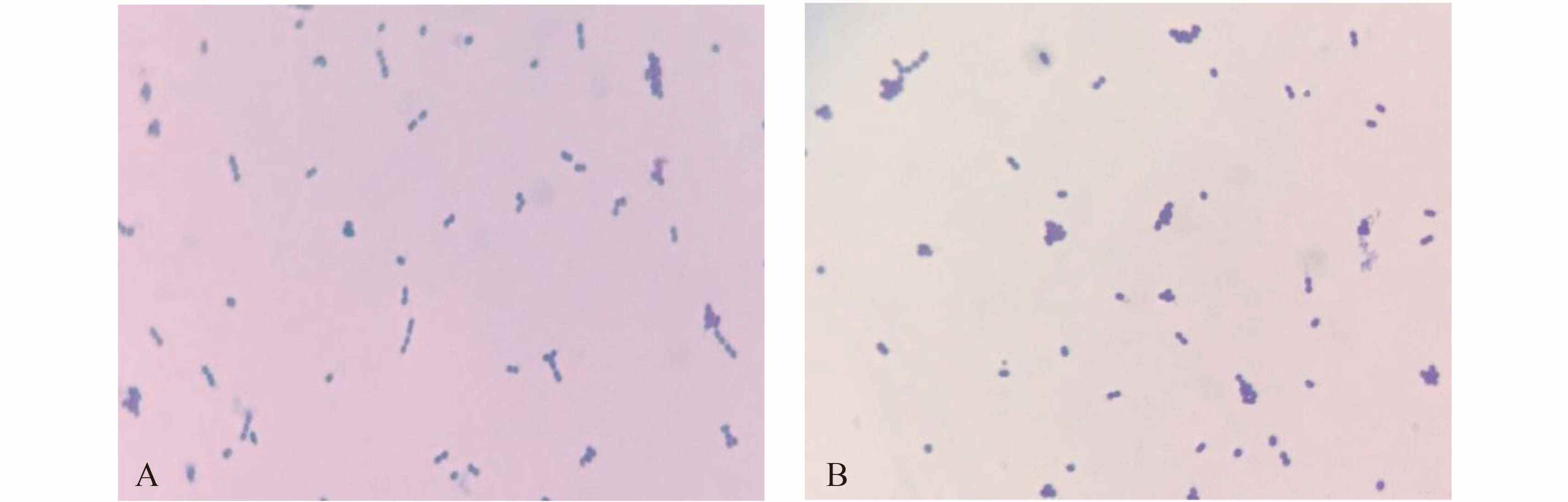 [microscope的前缀]microscope是什么意思?